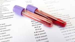  Magnesium Deficiency test